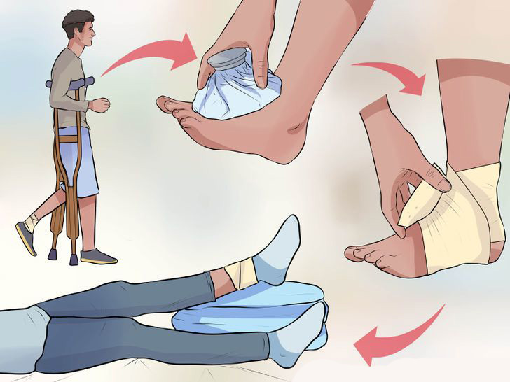 Các bước xử lý và điều trị khi gặp chấn thương lật cổ chân